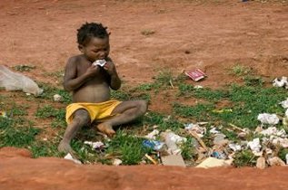 Cameroon Malnutrition