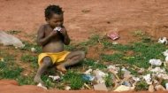 Cameroon Malnutrition