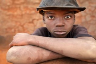 Street Children in Malawi